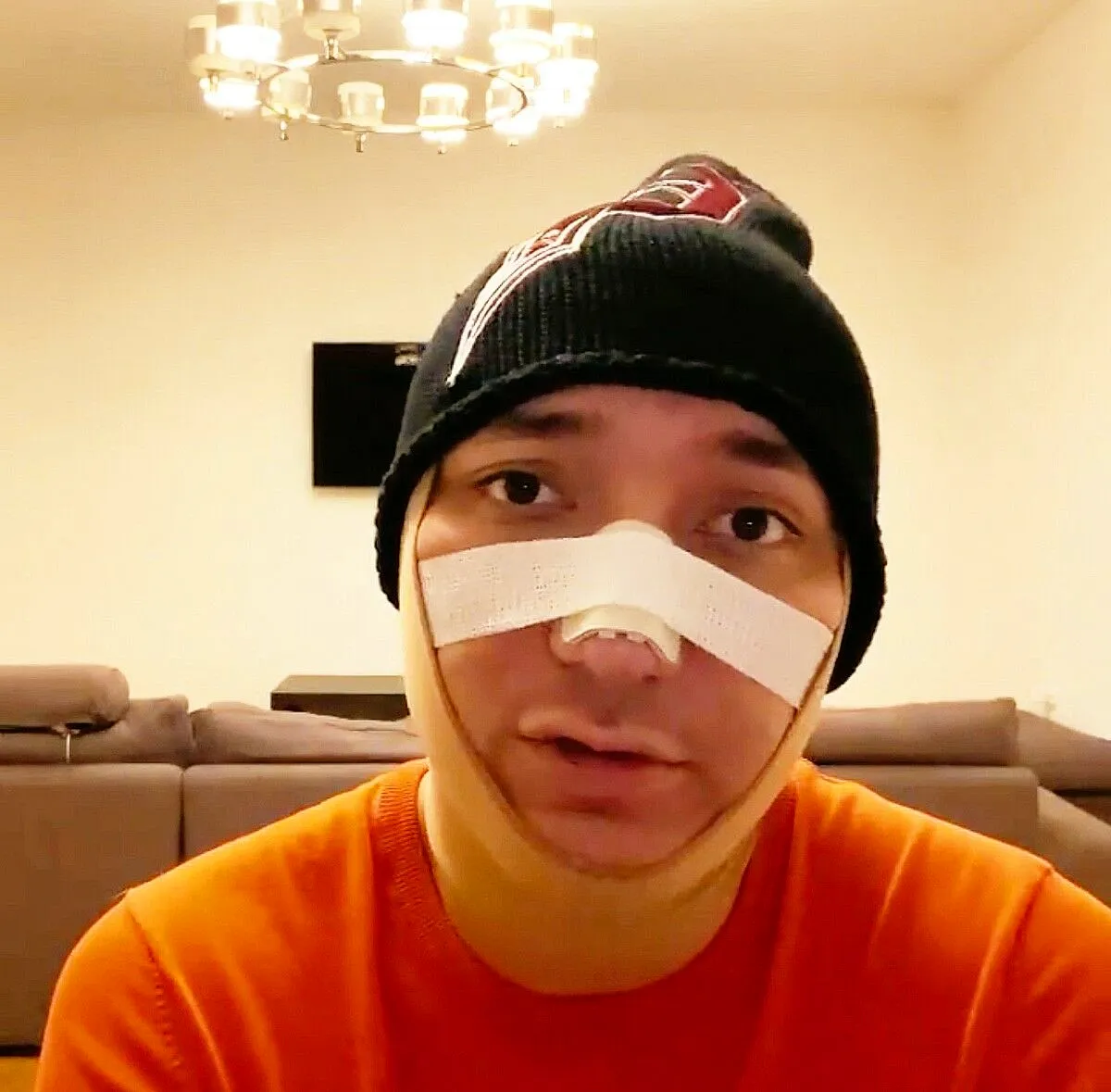 Алишер Каримов пластическая операция на нос