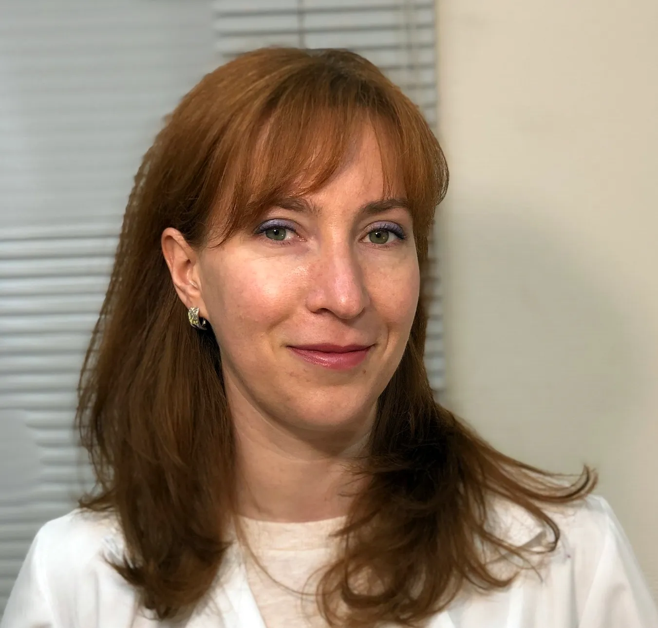 Суринова Наталья Владимировна невролог Липецк