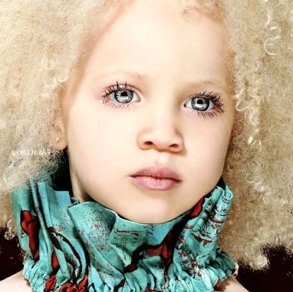 Ава Кларк — афроамериканка-альбинос.