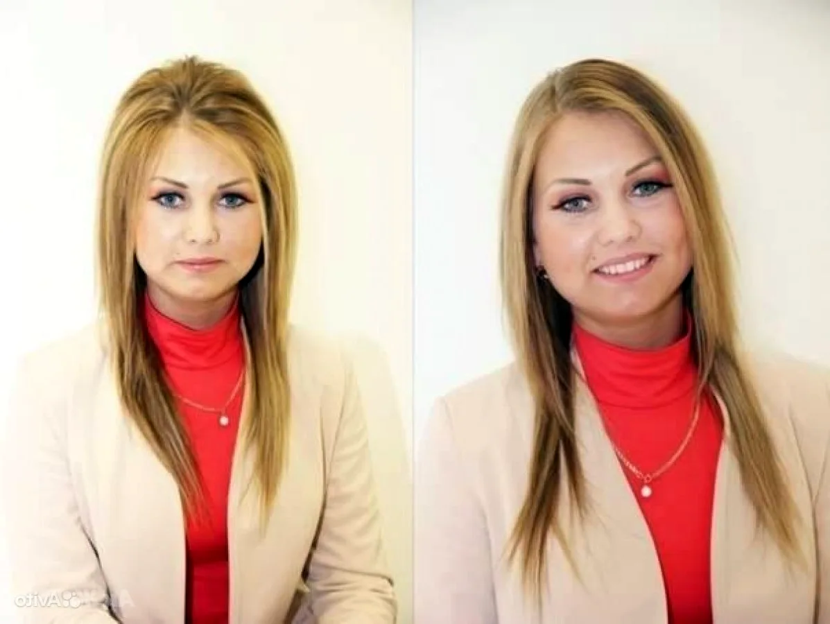 Елена Глинка буст ап