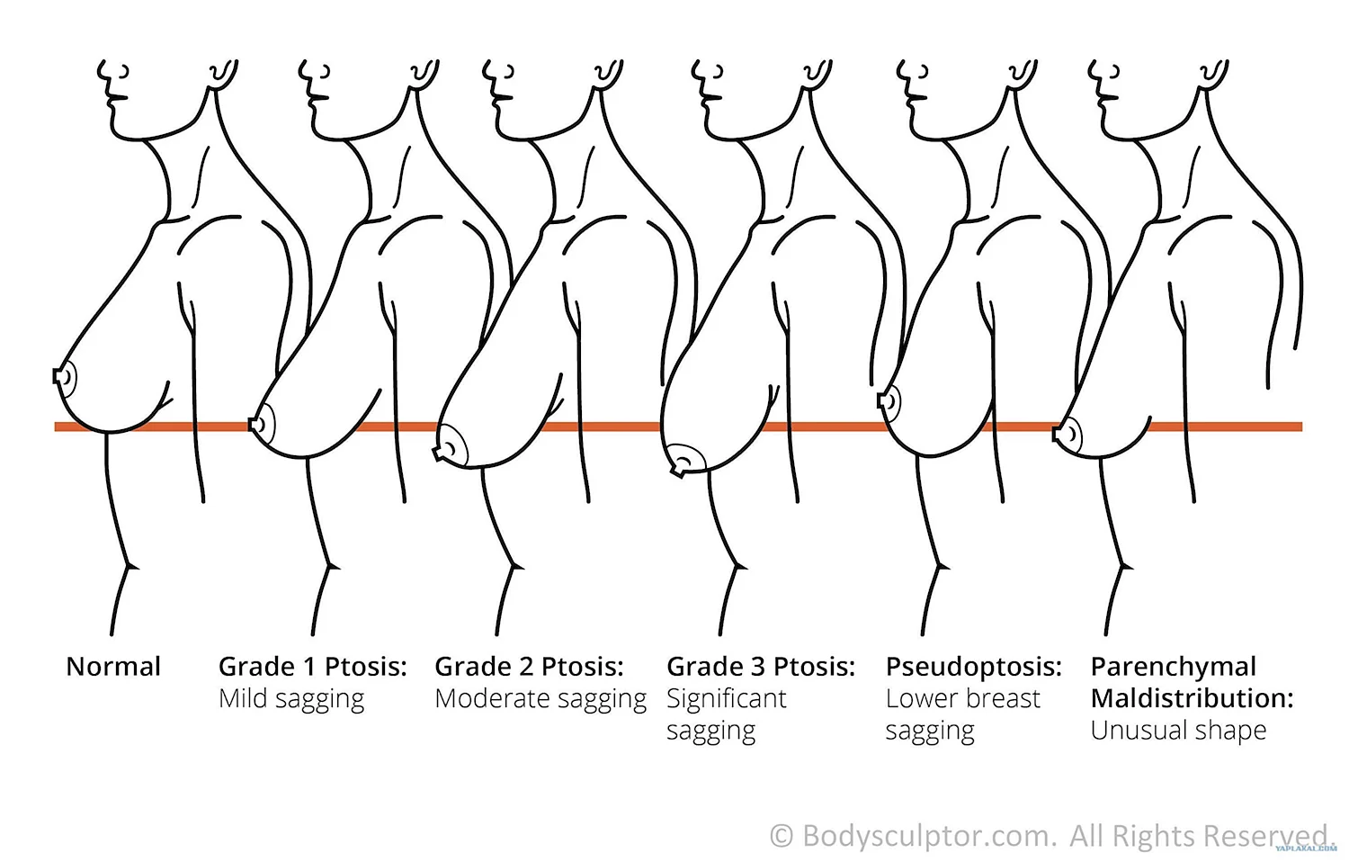 Типы женской груди. Значок груди женщин, значок груди векторные иллюстрации