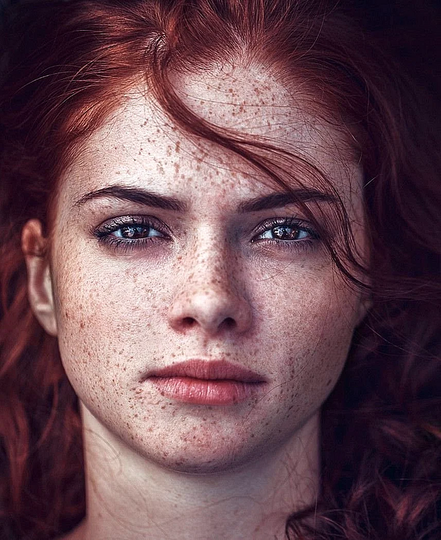 Freckles Эвелина Лашук