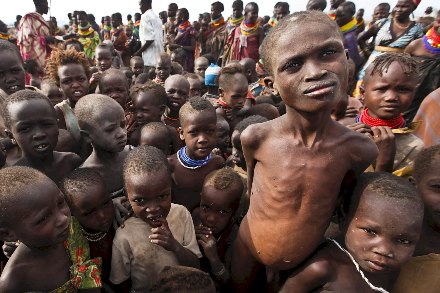Голодающыые дети Африке