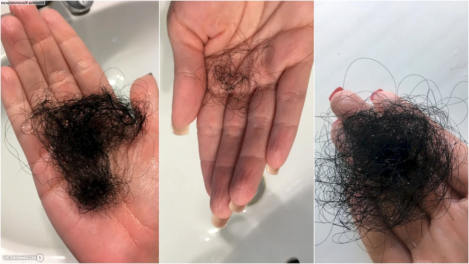Норма выпадения кудрявых волос