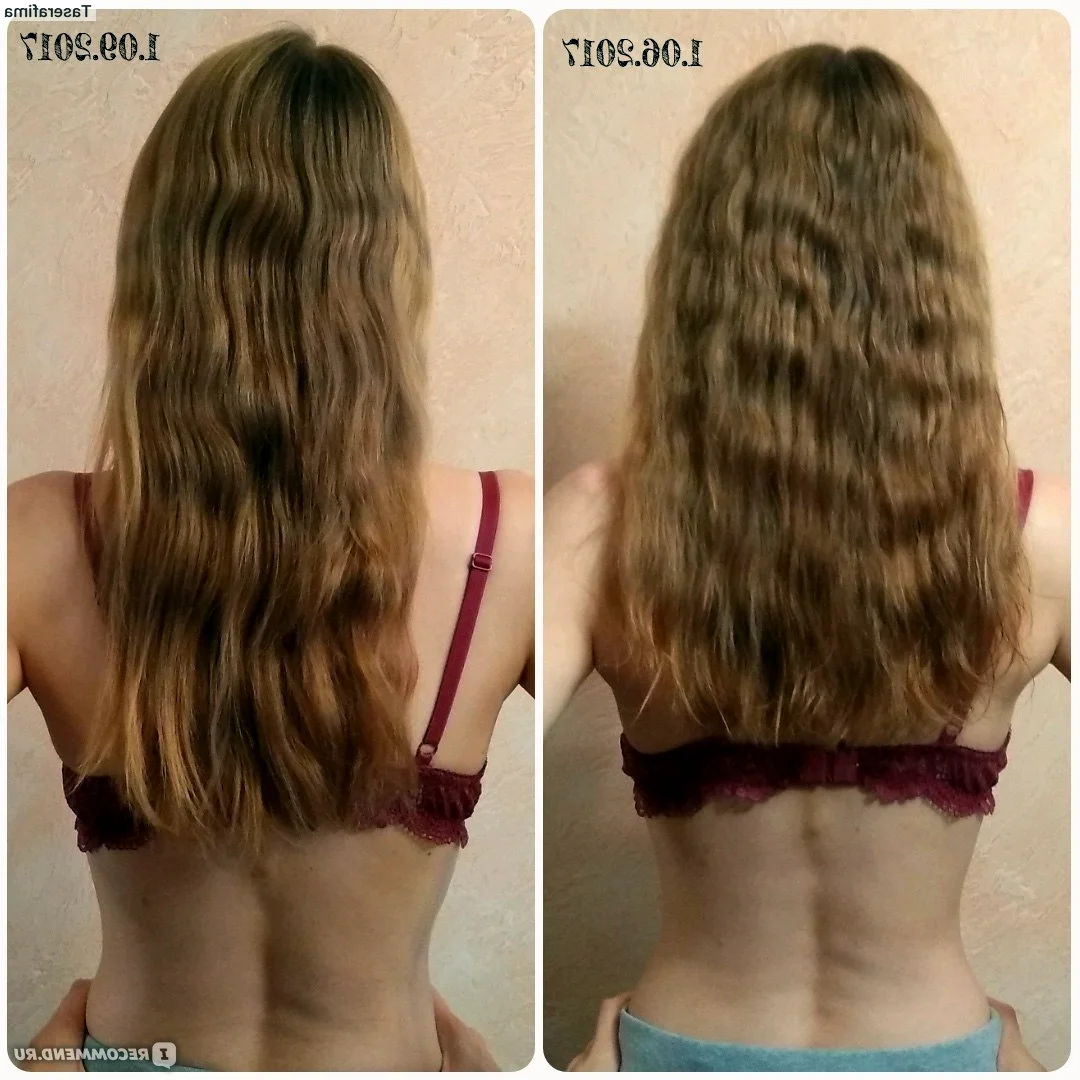 Пантовигар для волос до и после