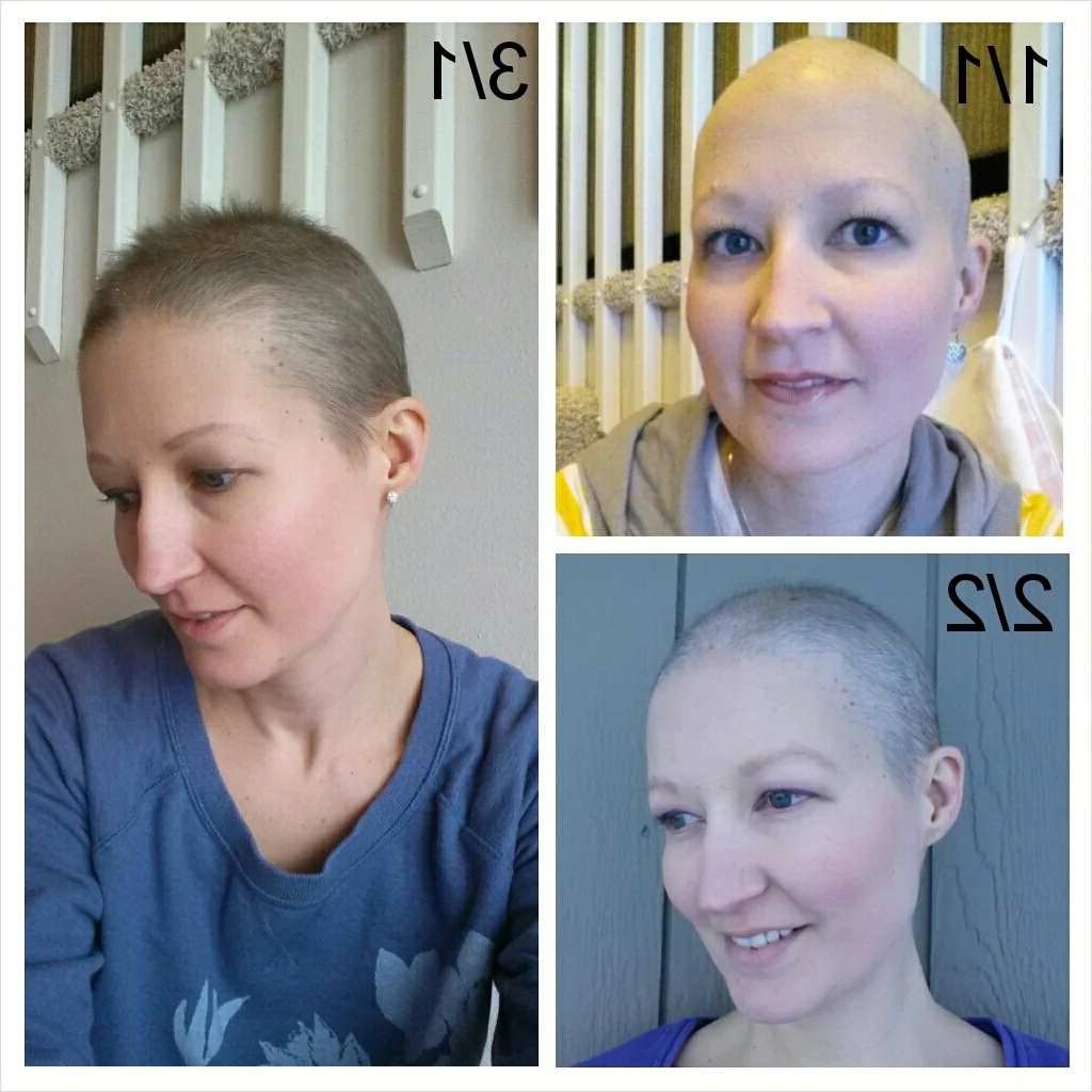 Прическа после химиотерапии