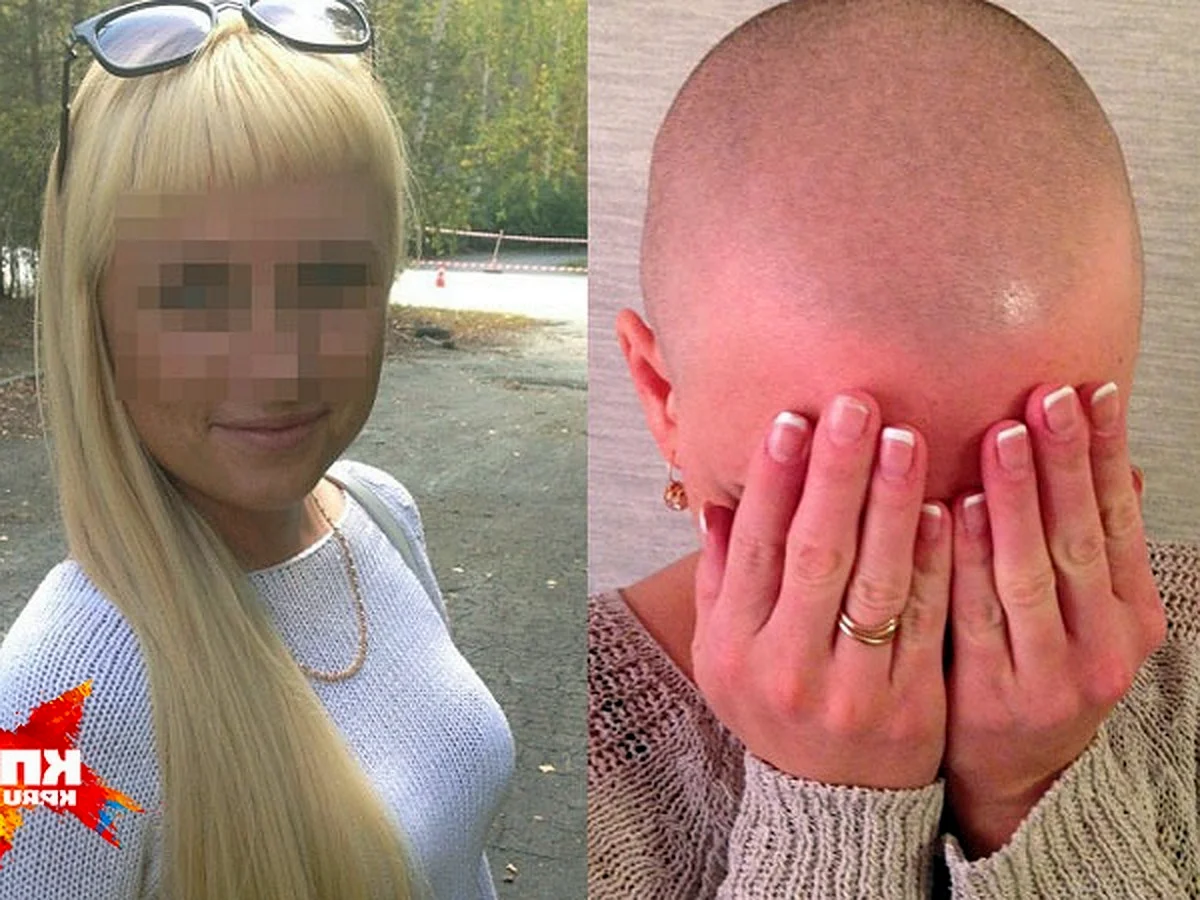 Волосы после химиотерапии до и после