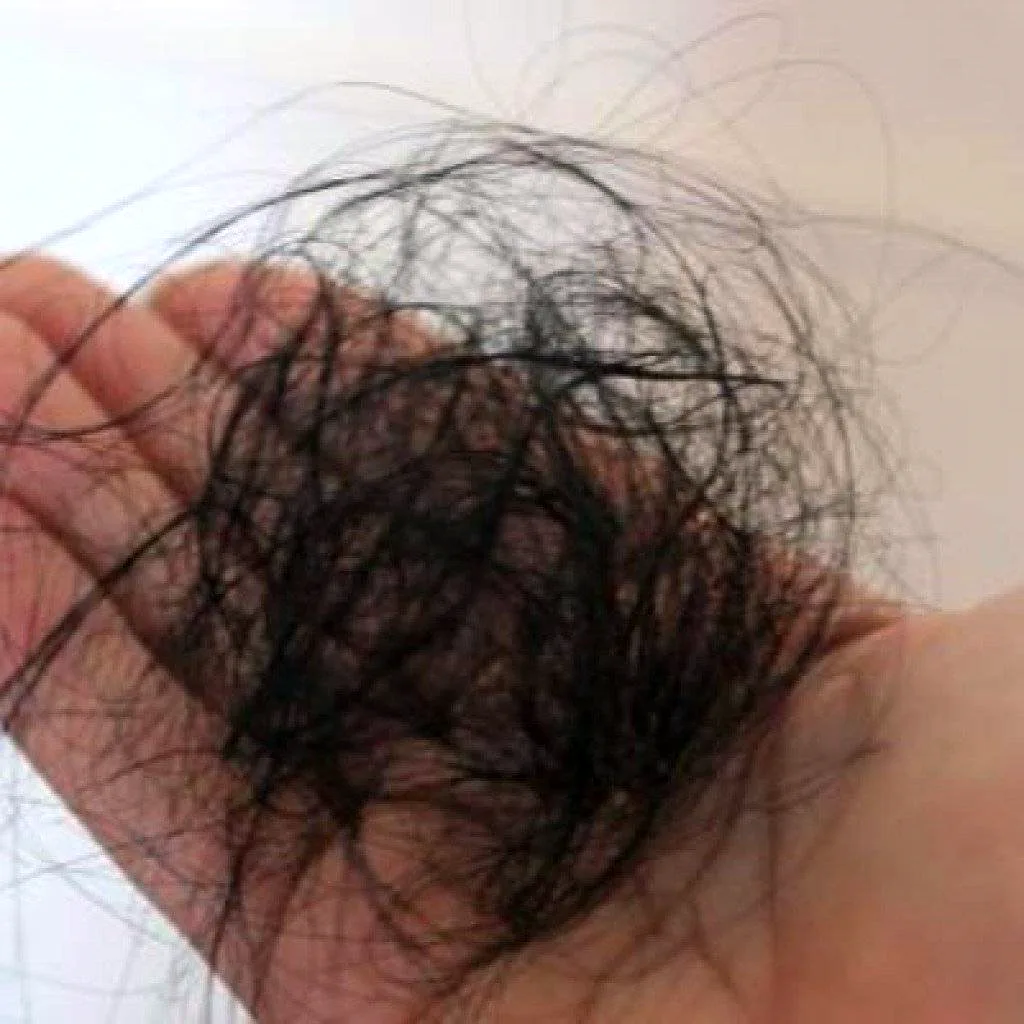 Выпадкник волос клоком