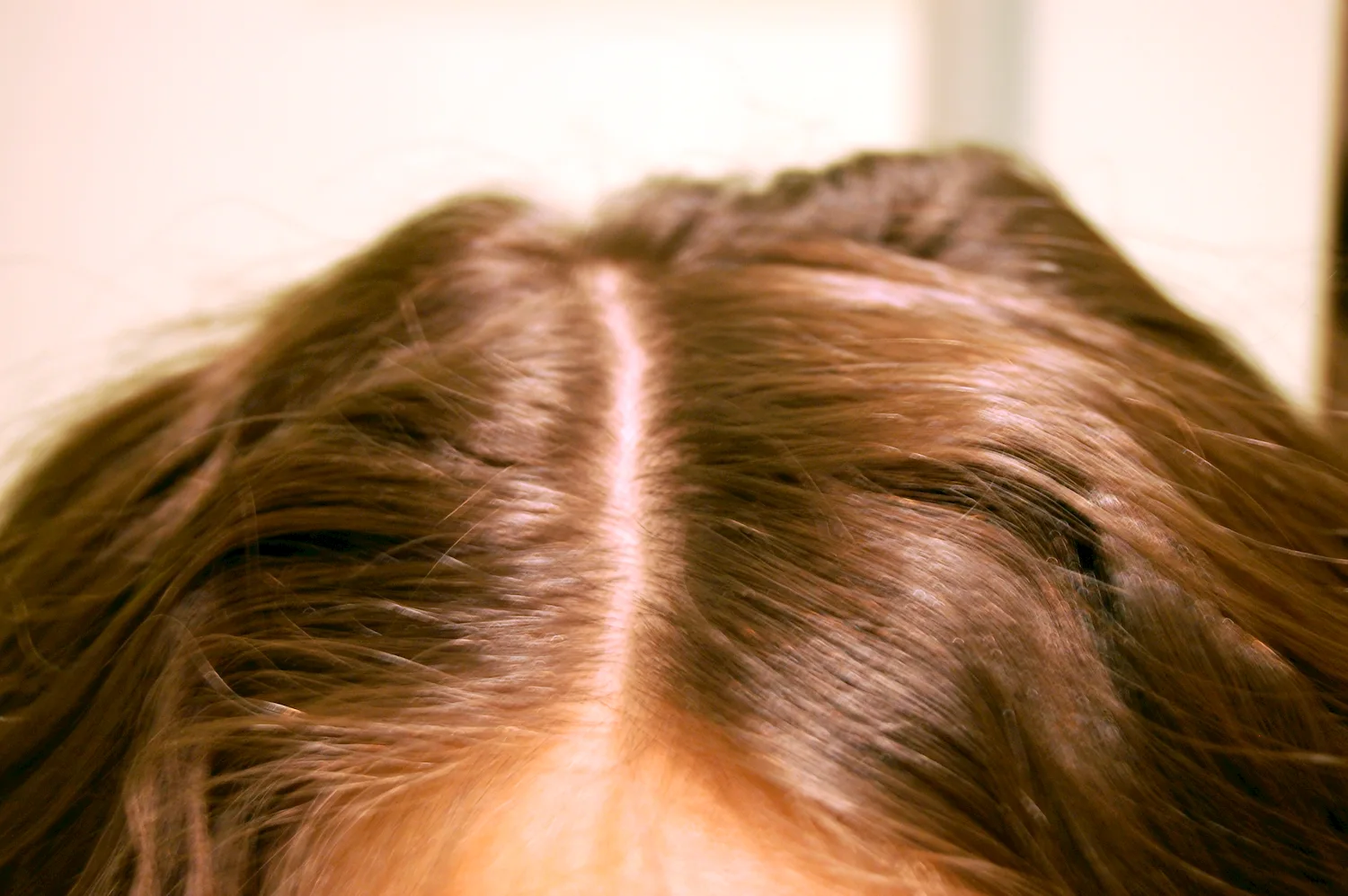Почему на волосах остается след от резинки