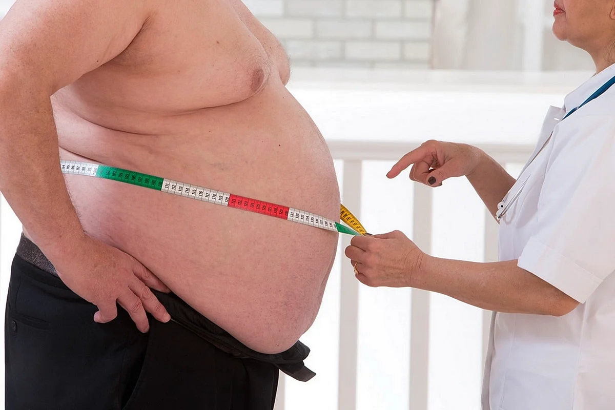 Абдоминальное и висцеральное ожирение