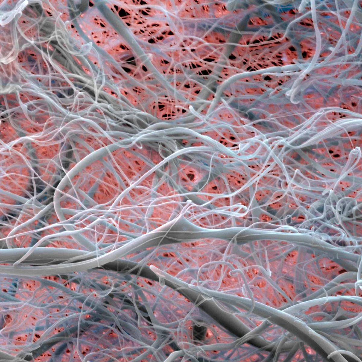 Коллагеновые волокна соединительной ткани