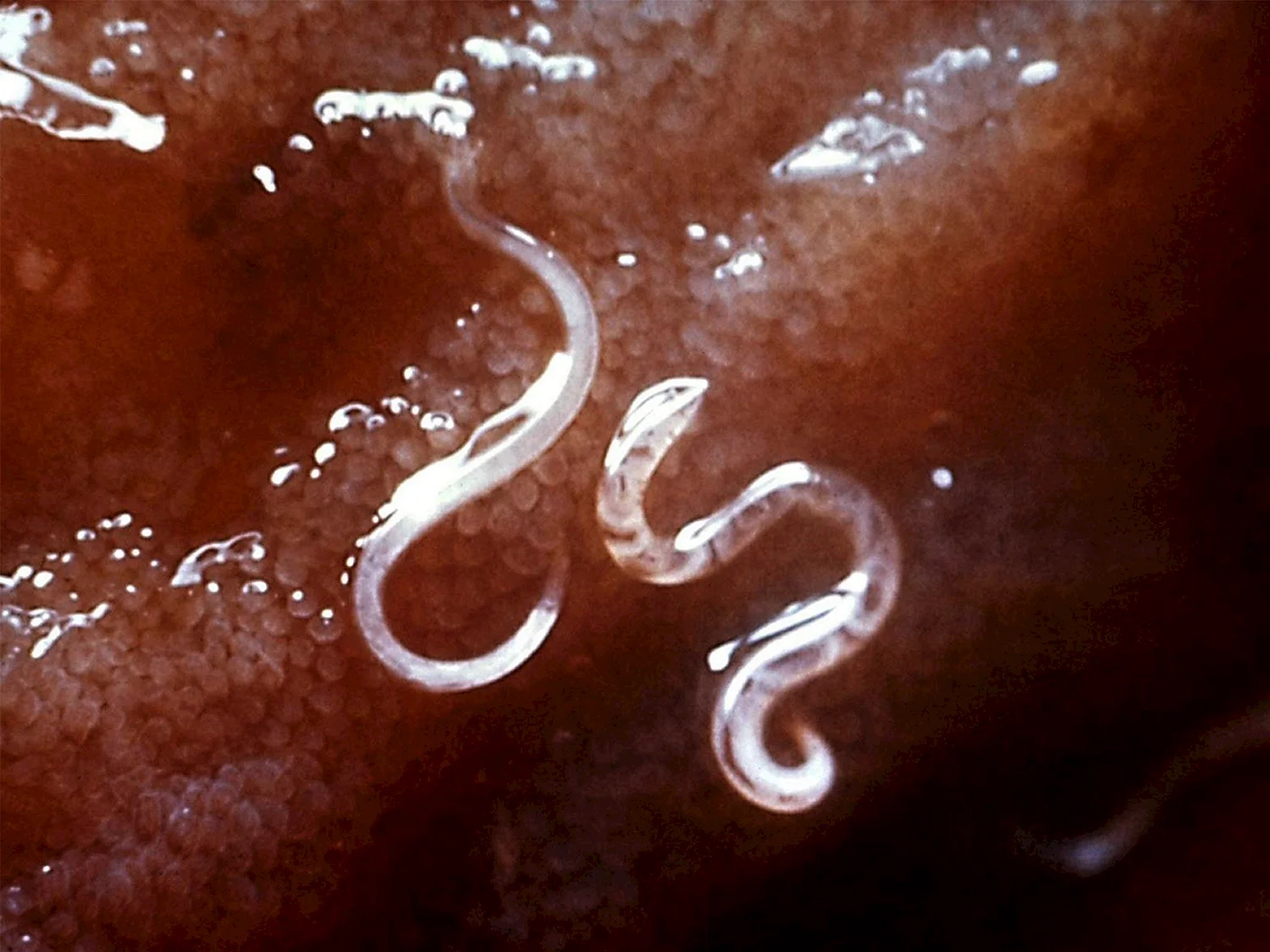 Круглые черви анкилостомы