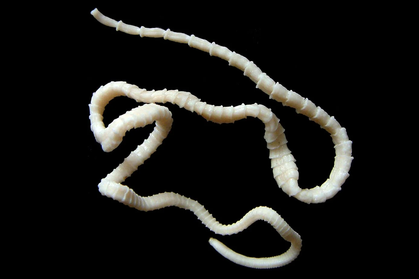 Ленточные черви (цестоды)