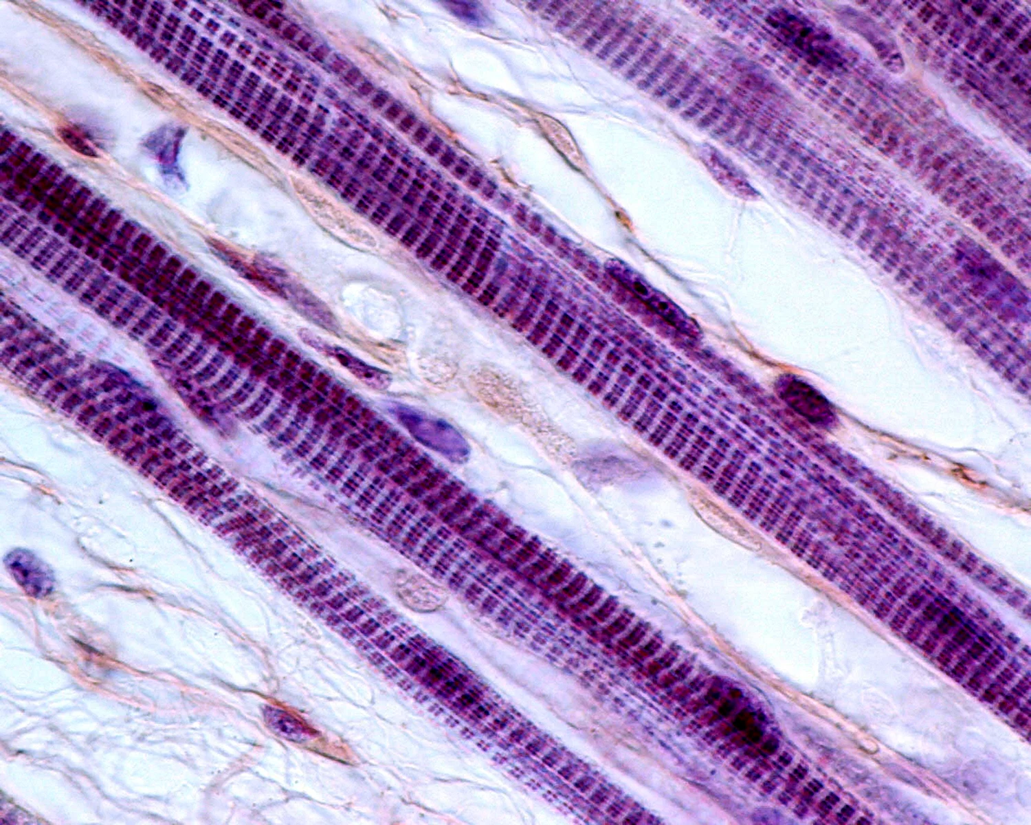 Поперечно-полосатая Скелетная мышечная ткань под микроскопом