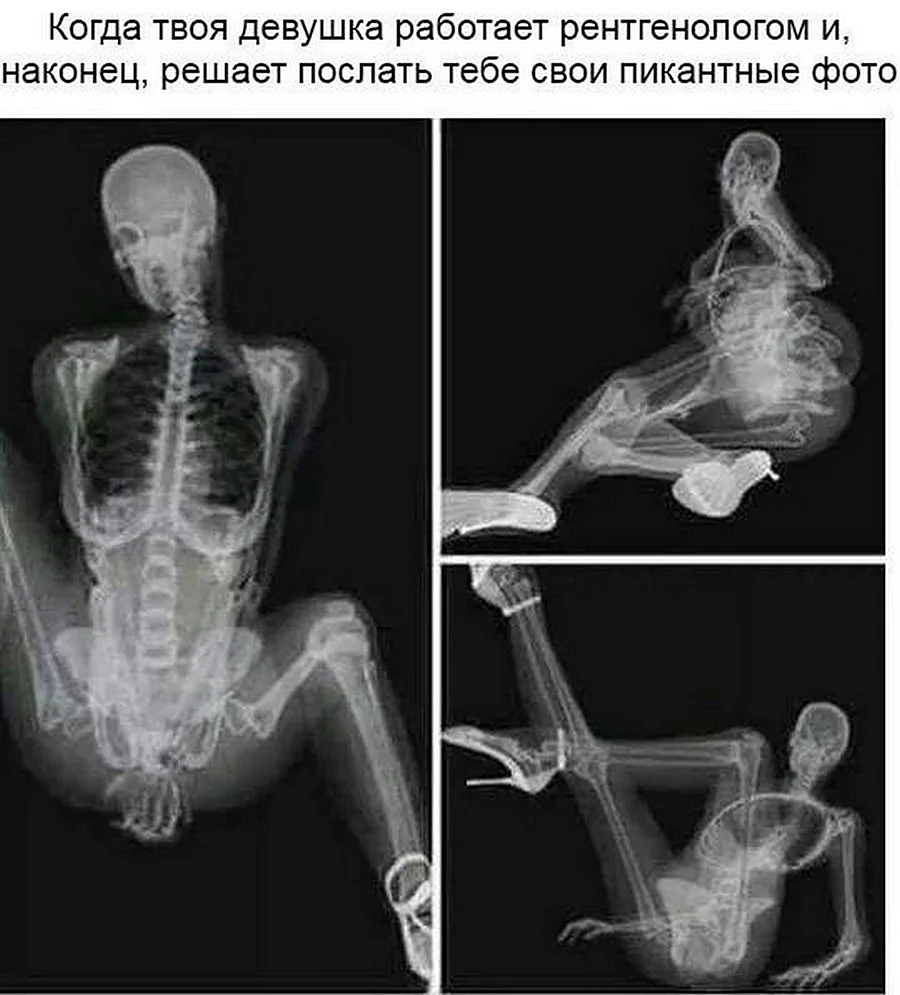 Прикольные рентгеновские снимки