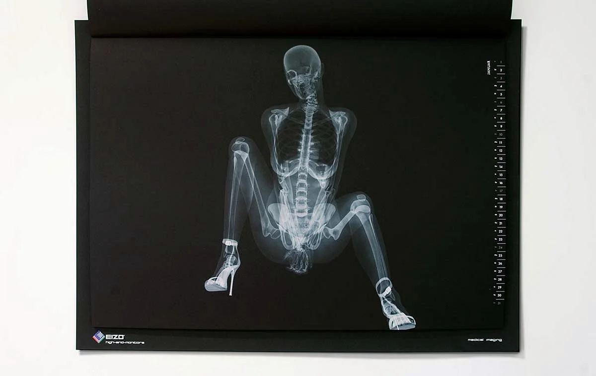 Рентген ноутбука