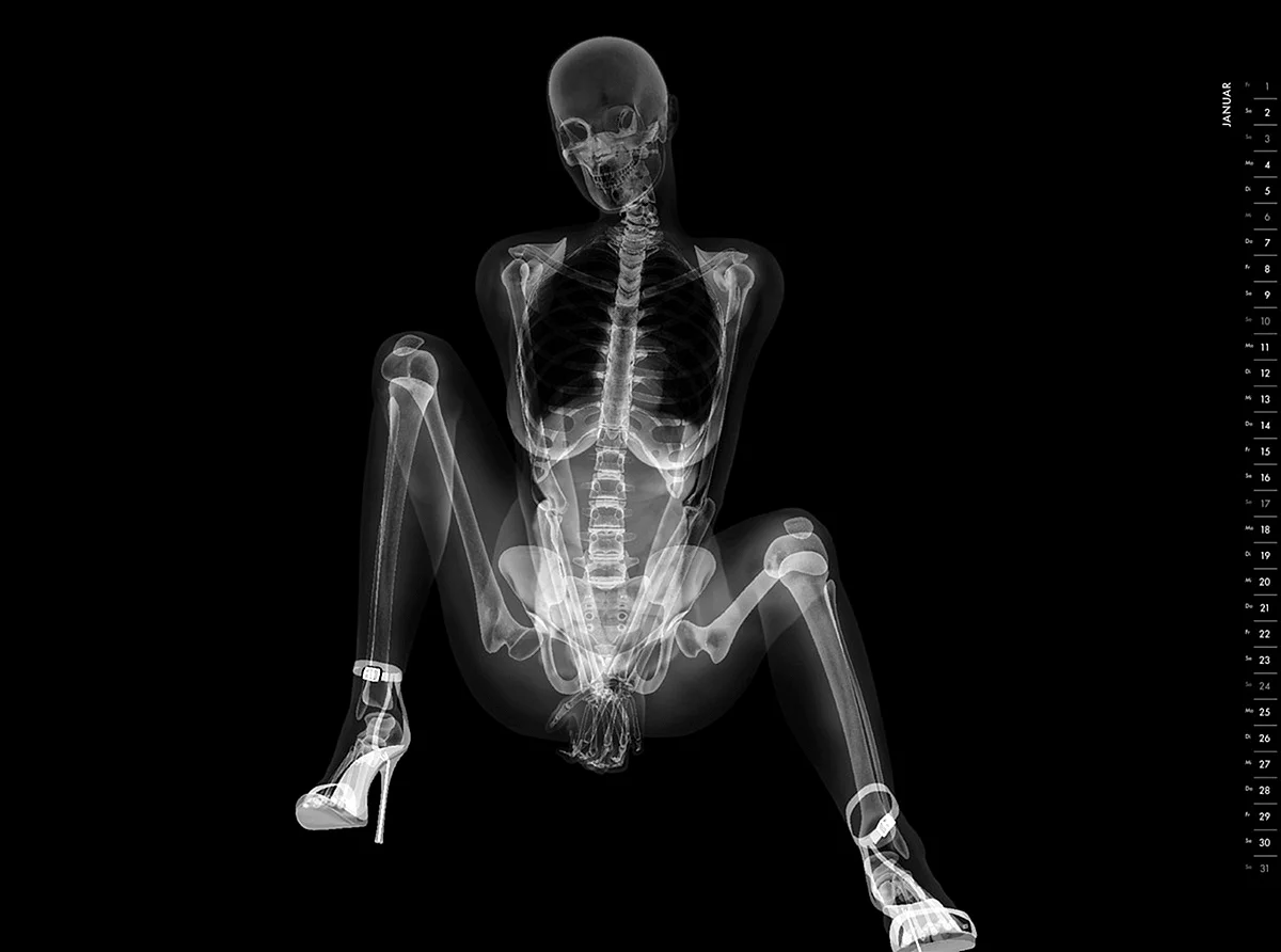 Рентген женщины