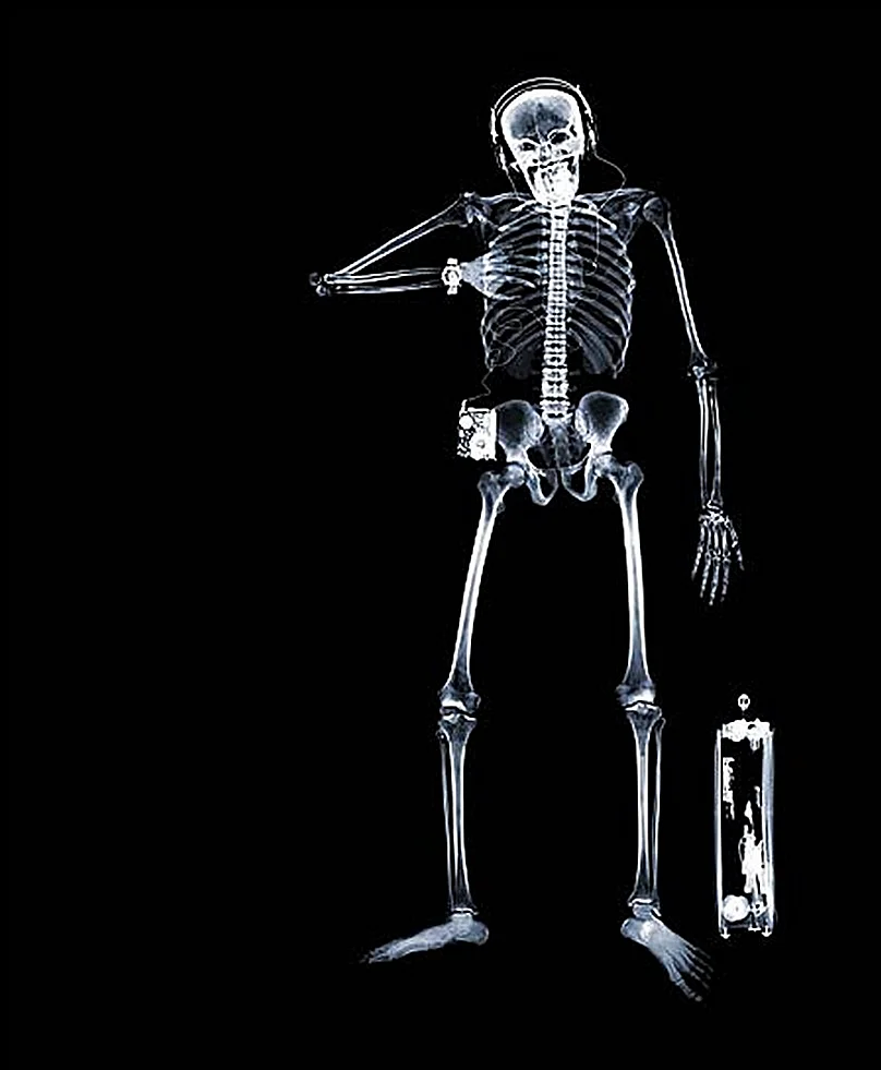 Рентгенограмма скелета