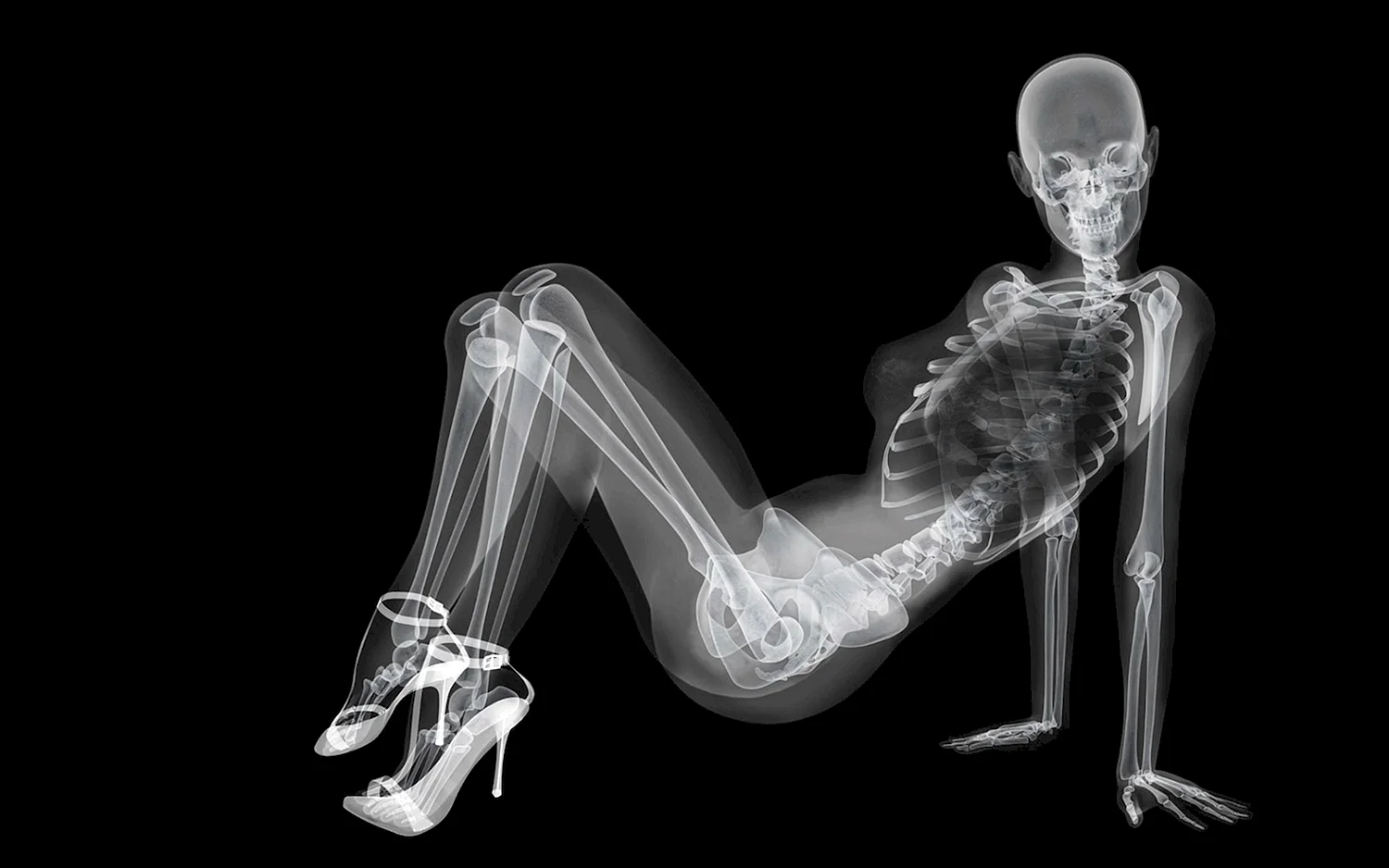 Рентгеновский снимок