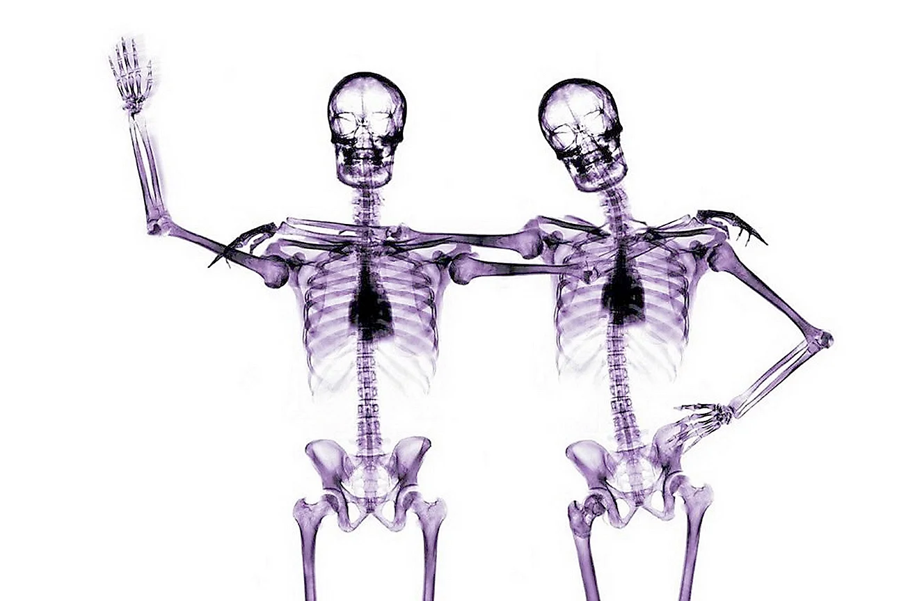 Скелет под рентгеном в разных позах