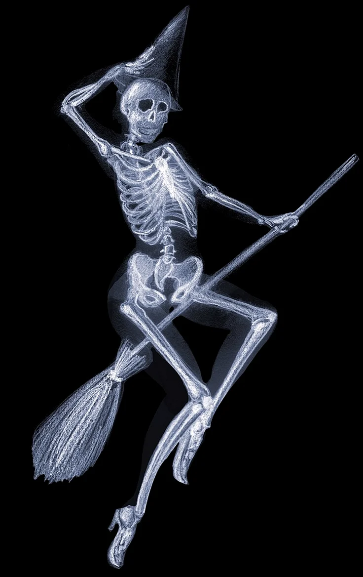 Скелет рентген