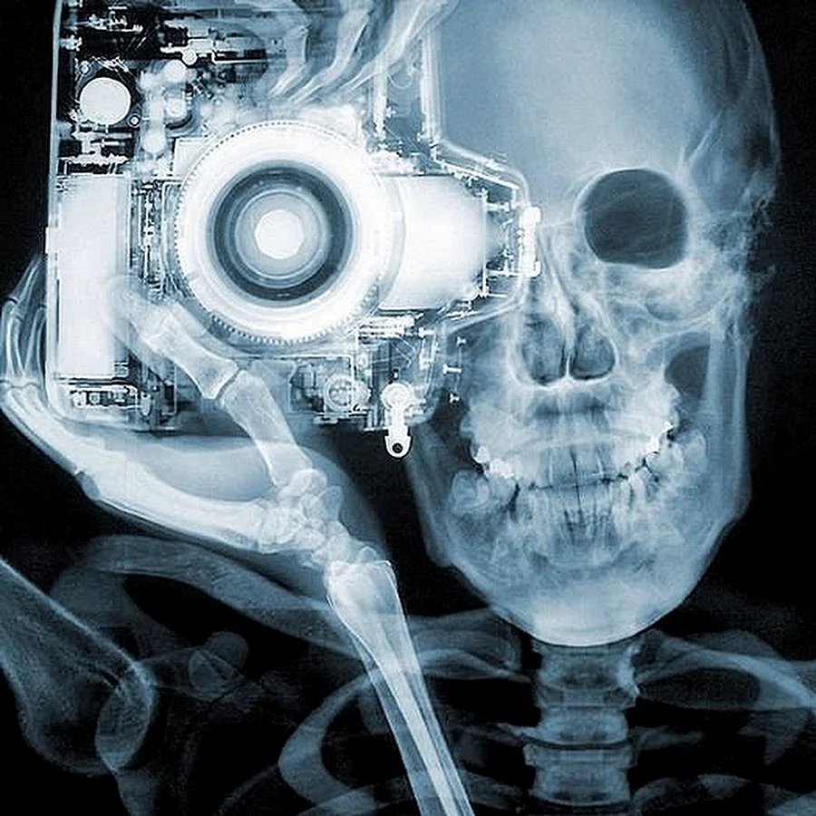 X ray рентгеновские лучи